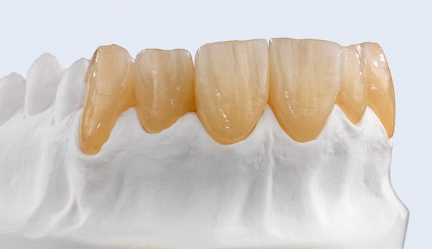 Ceramill Multilayer